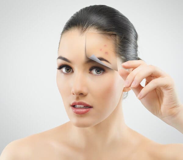 BodyLase® Med Spa - BodyLase acne vs laser treatments