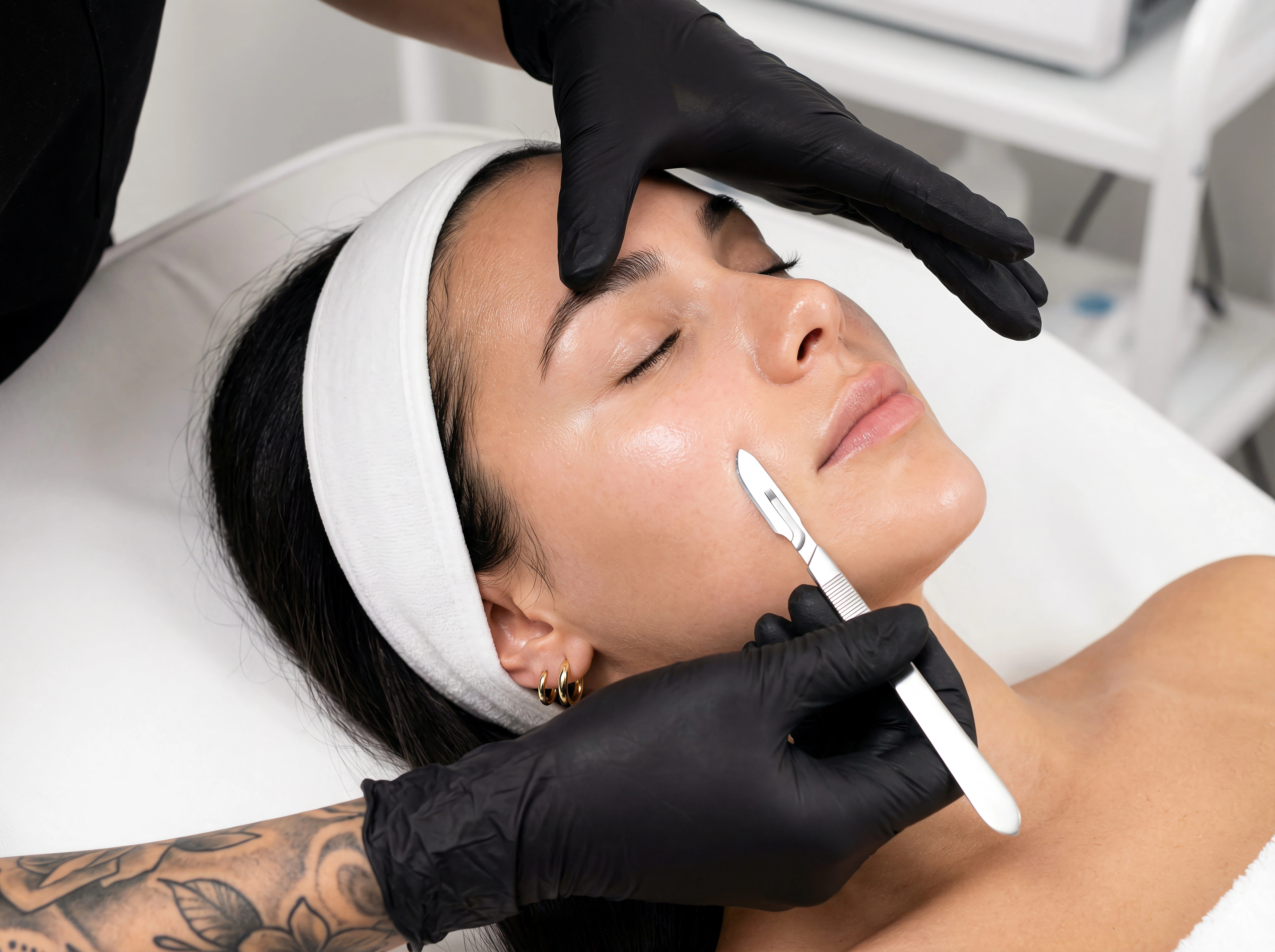 BodyLase® Med Spa - Dermaplaning
