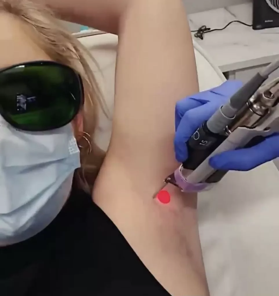 BodyLase® Med Spa - Laser Hair Removal BodyLase