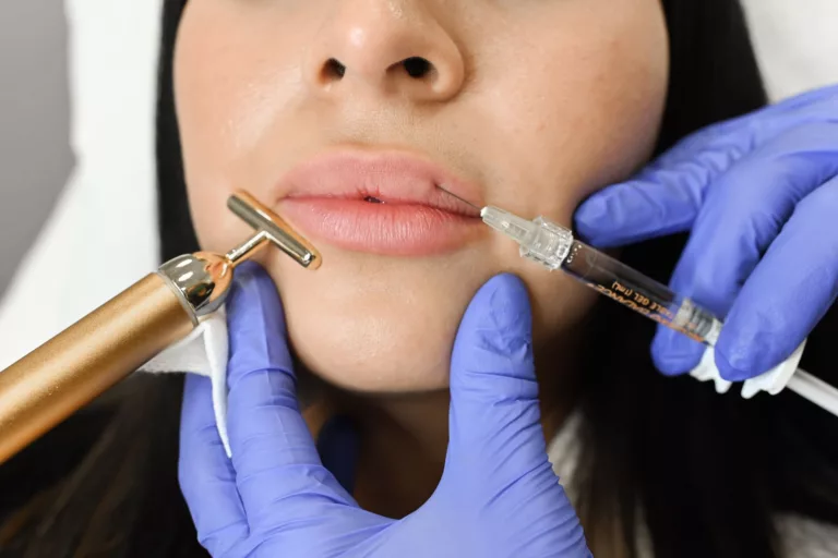 Types of Fillers