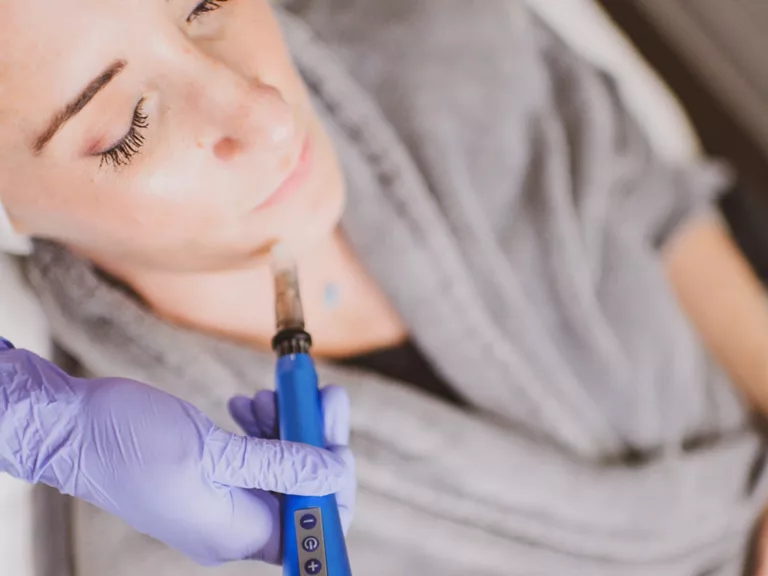 What is RF Microneedling?