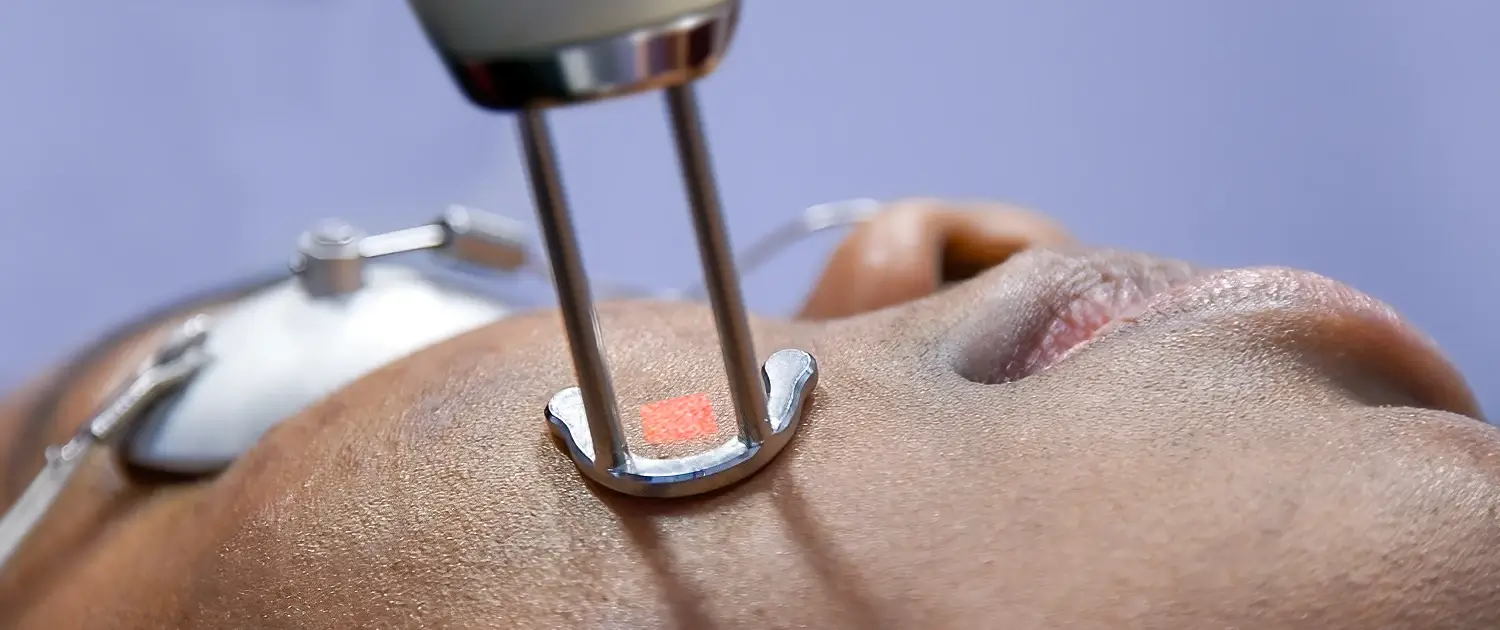 BodyLase® Med Spa - header spots removal laser dark skin 1